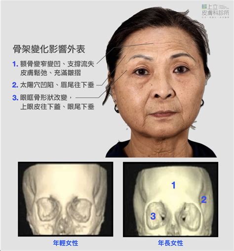 夫妻宮凹陷化解